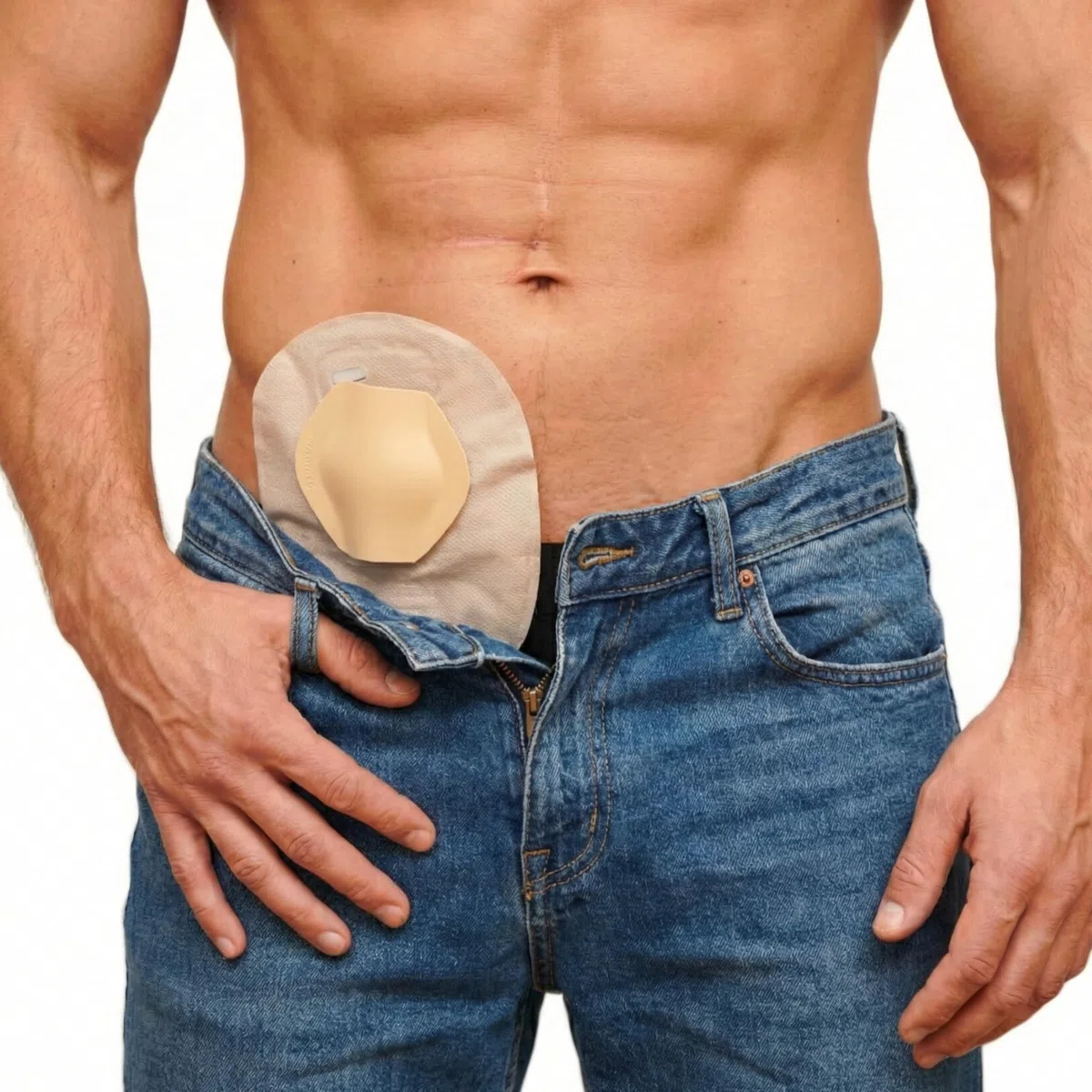 SIIL Protector de estoma | Protector de Ostomia Ostomy | Accesorios de Ostomia | Stoma protector | Stoma Shield | Stoma Guard